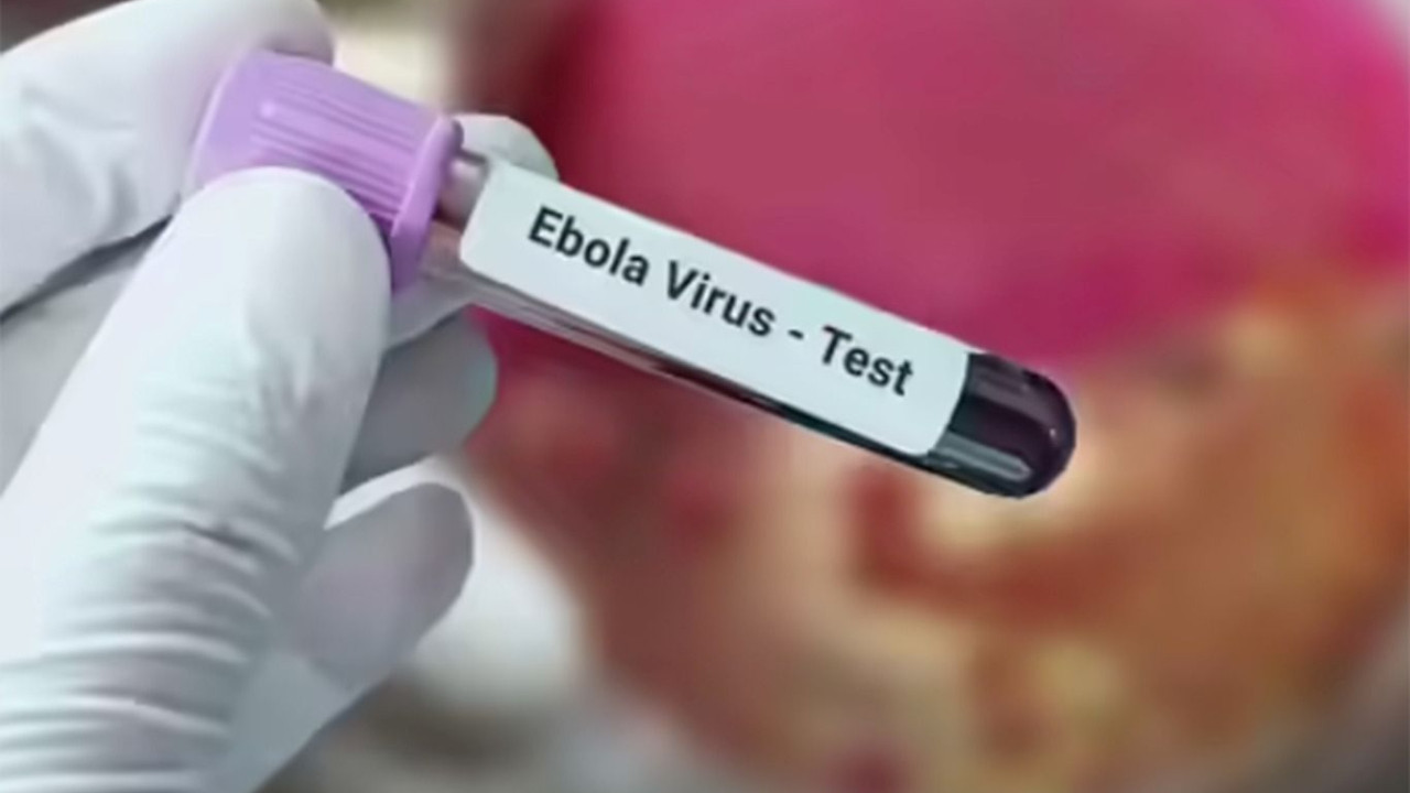 Korkutan Ebola açıklaması! 