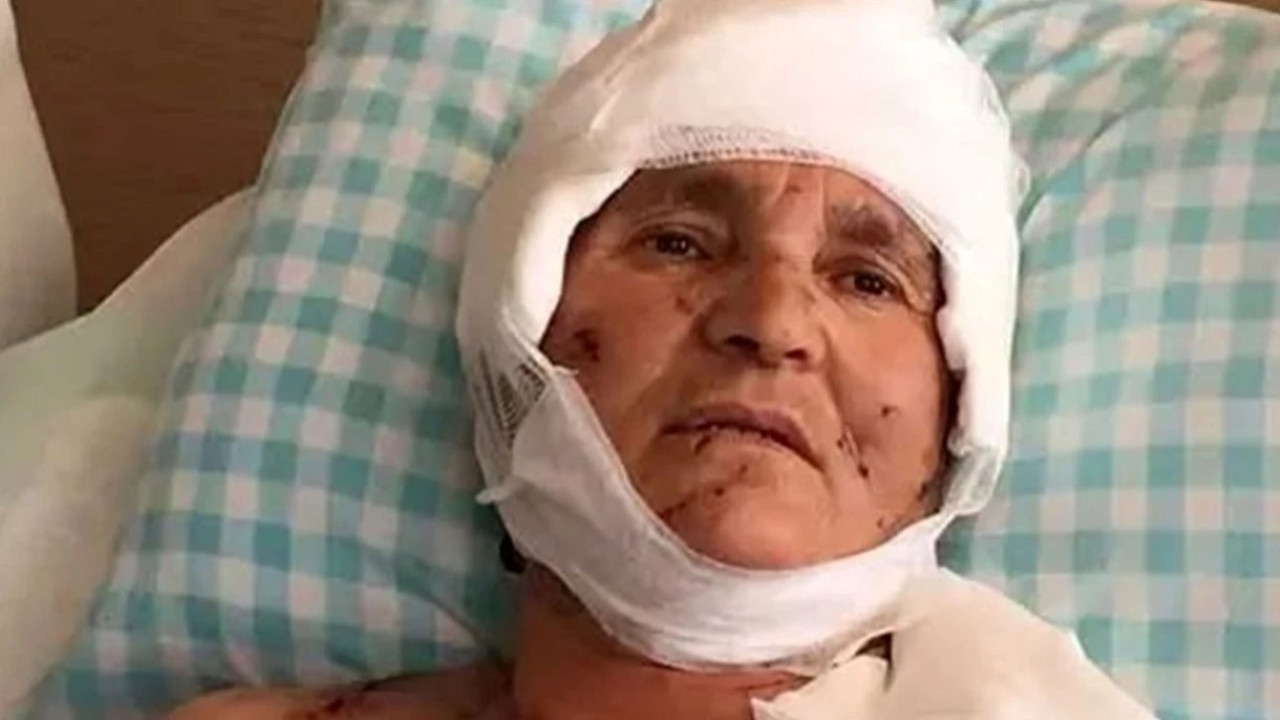 Yargıtay'dan emsal köpek saldırısı kararı: Bahçesinde serbest bırakan tazminat ödeyecek!